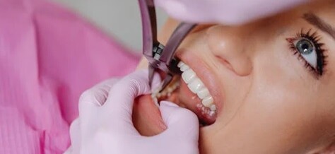 Tooth Extraction: Everything You Need to Know