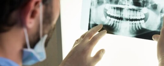 What are dental x-rays and why are they important?
